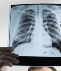 Optima Tuberculosis modelling